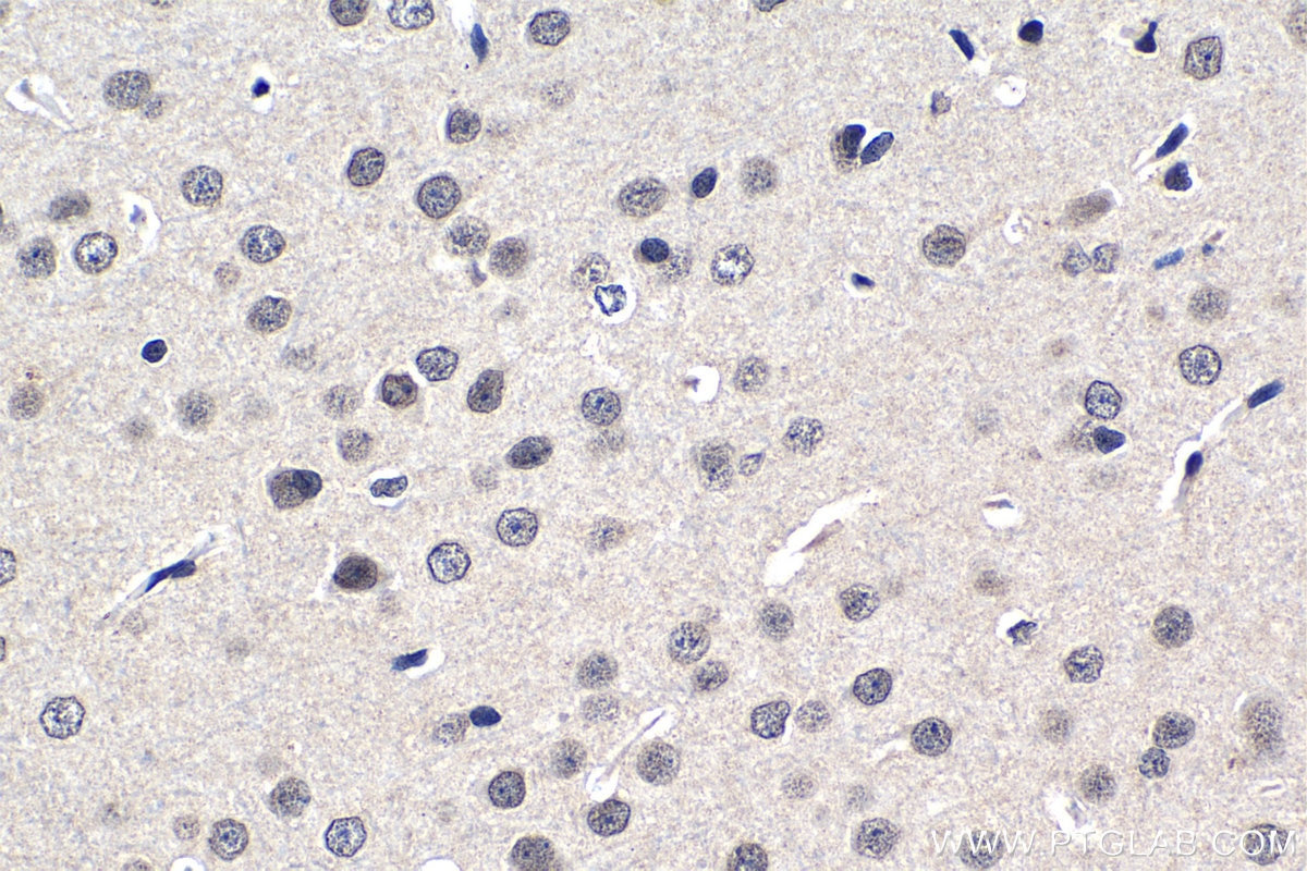 Immunohistochemical analysis of paraffin-embedded rat brain tissue slide using KHC1202 (NUP85 IHC Kit).