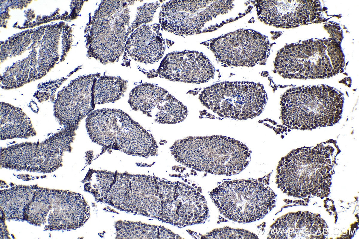 Immunohistochemical analysis of paraffin-embedded mouse testis tissue slide using KHC1202 (NUP85 IHC Kit).