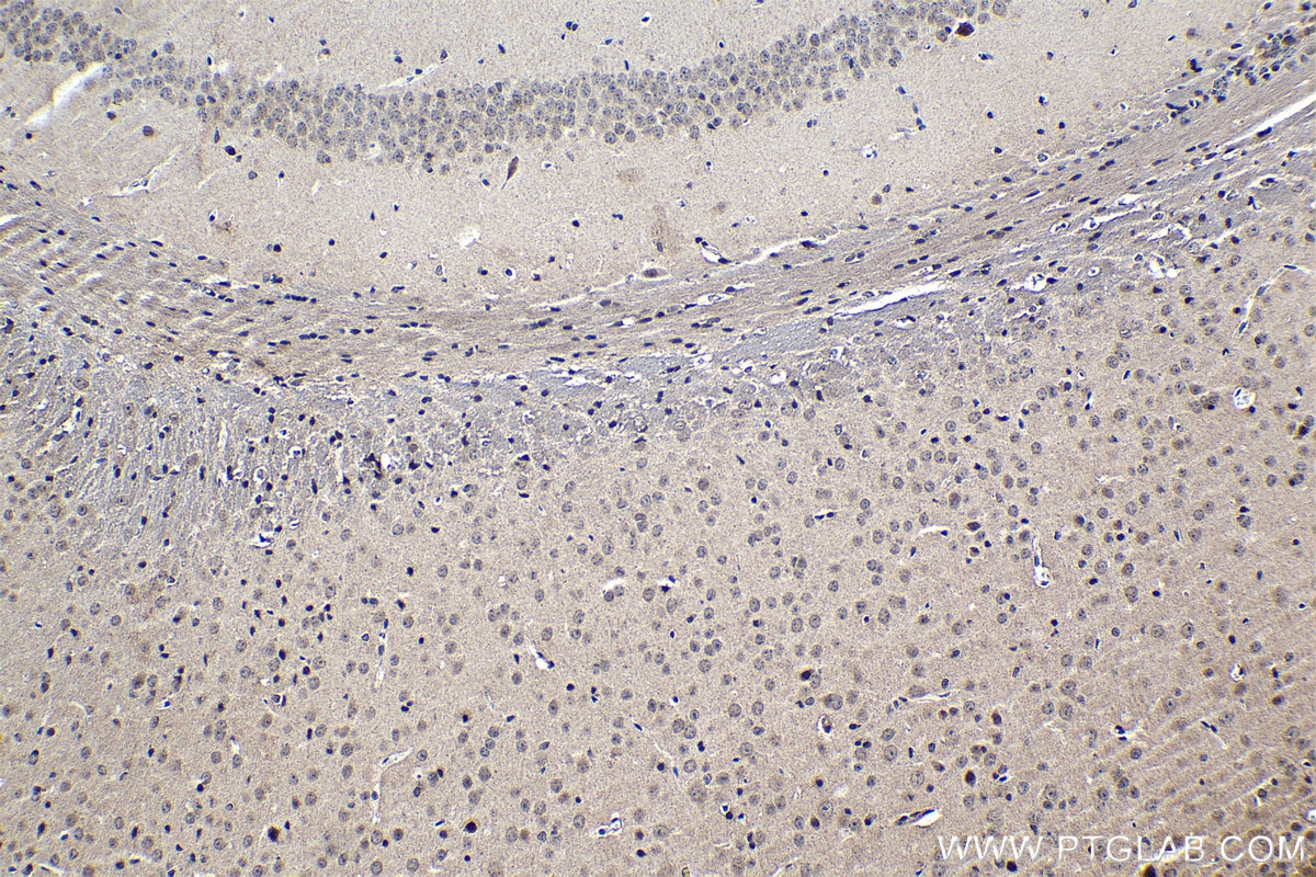 Immunohistochemical analysis of paraffin-embedded mouse brain tissue slide using KHC1202 (NUP85 IHC Kit).