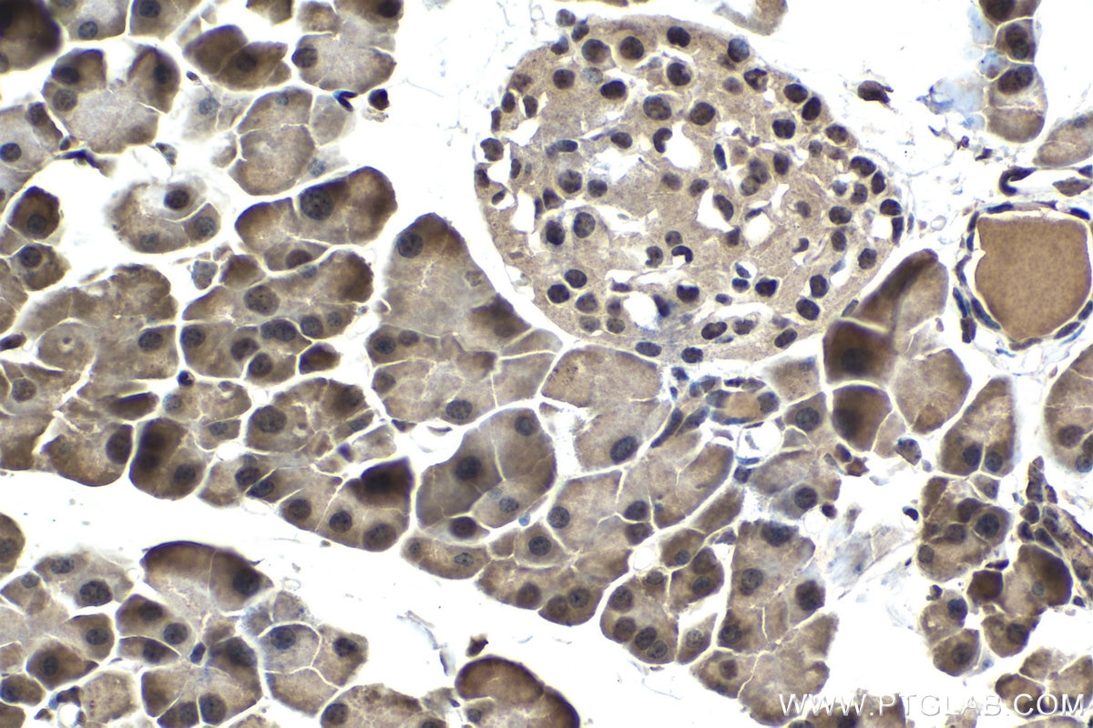Immunohistochemical analysis of paraffin-embedded mouse pancreas tissue slide using KHC1466 (NUPR1 IHC Kit).