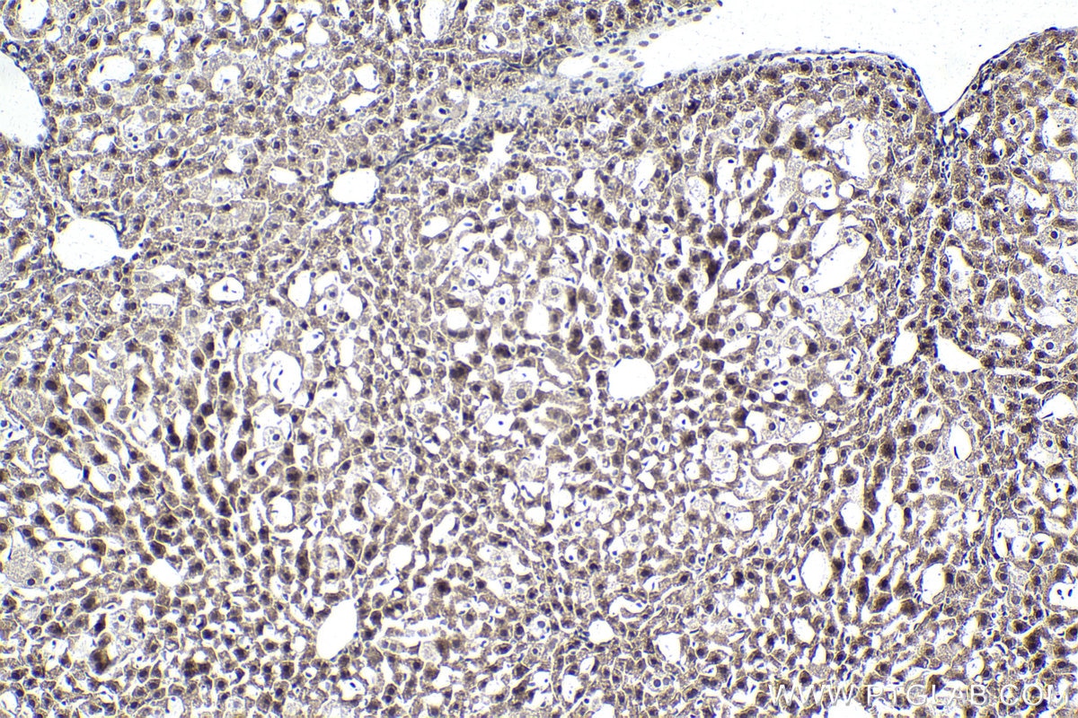 Immunohistochemical analysis of paraffin-embedded mouse liver tissue slide using KHC1466 (NUPR1 IHC Kit).