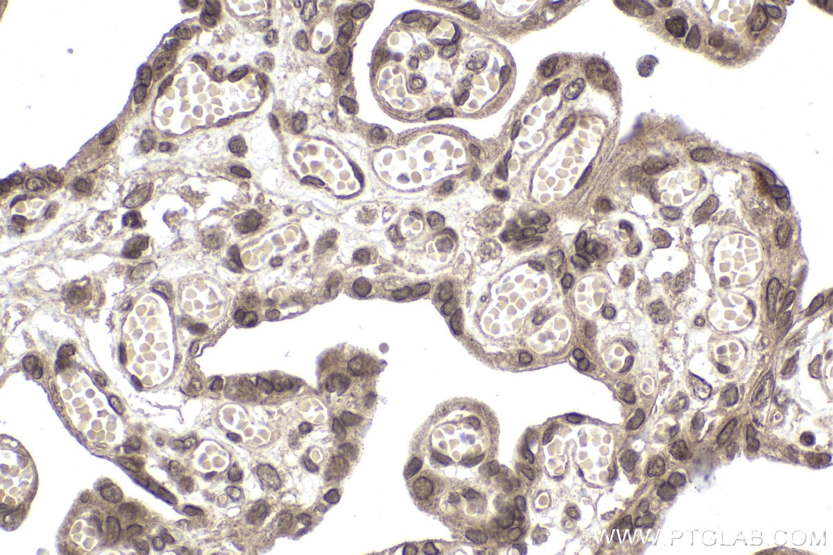 Immunohistochemical analysis of paraffin-embedded human placenta tissue slide using KHC1976 (NXF1 IHC Kit).
