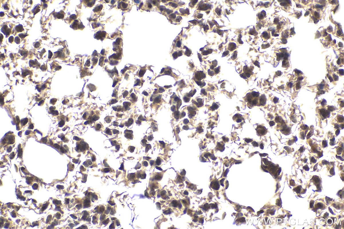Immunohistochemical analysis of paraffin-embedded mouse lung tissue slide using KHC1976 (NXF1 IHC Kit).