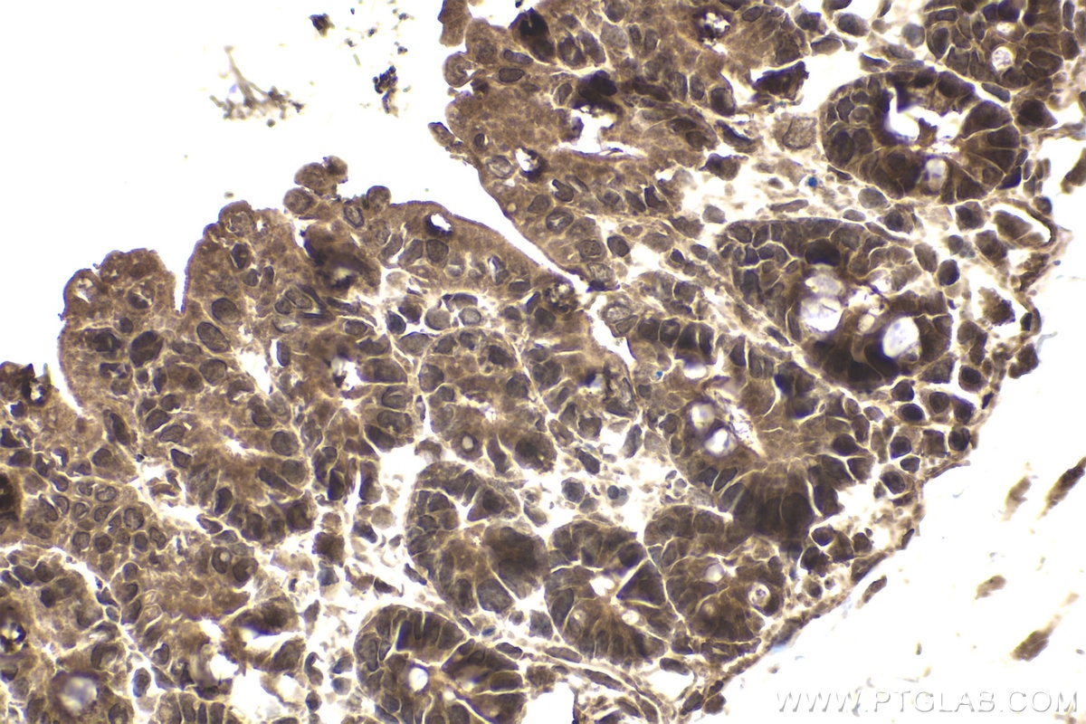 Immunohistochemical analysis of paraffin-embedded mouse small intestine tissue slide using KHC1976 (NXF1 IHC Kit).