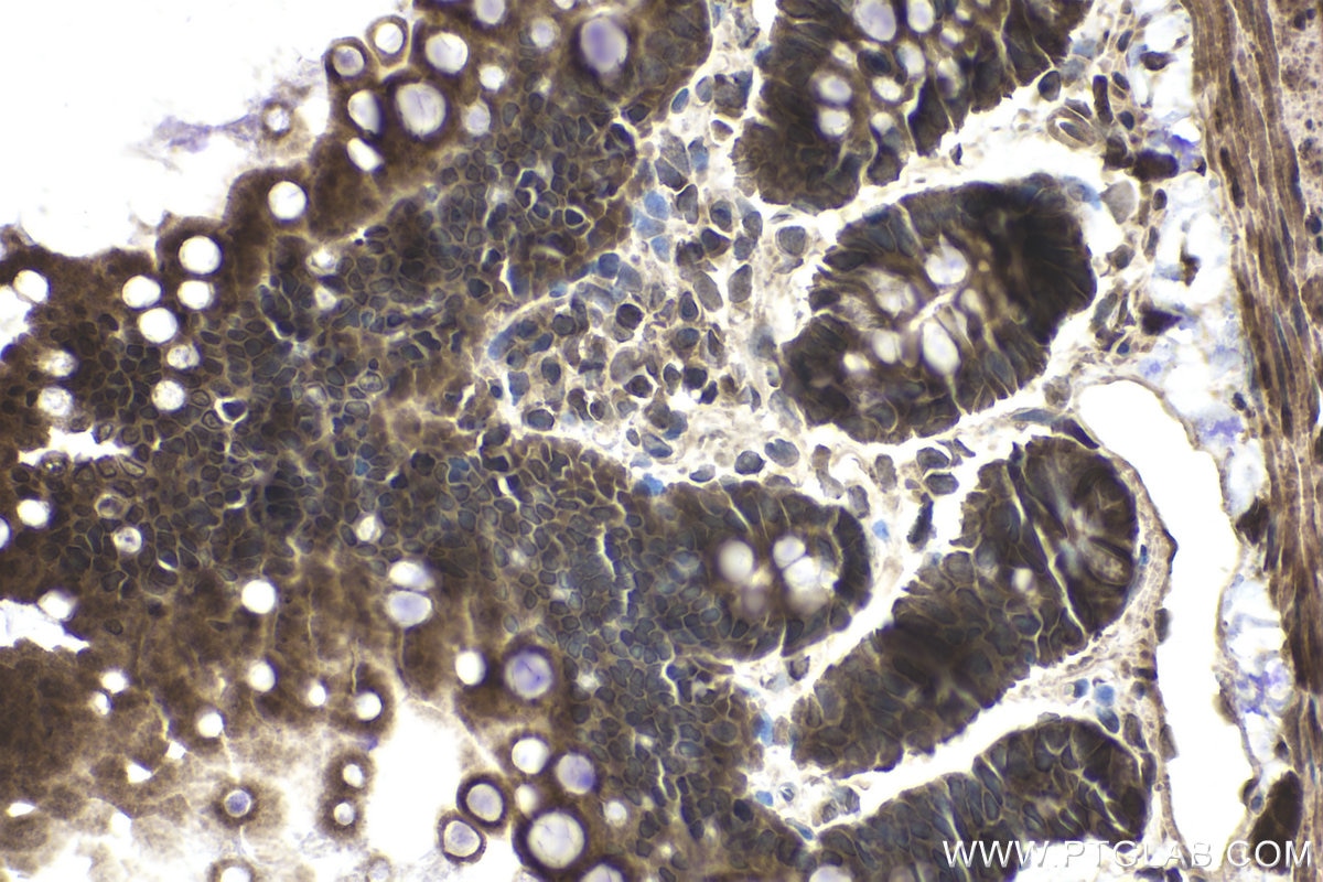 Immunohistochemical analysis of paraffin-embedded rat small intestine tissue slide using KHC1976 (NXF1 IHC Kit).