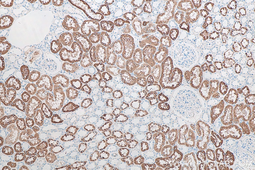 Immunohistochemical analysis of paraffin-embedded human kidney tissue slide using KHC0068 (Napsin A IHC Kit).