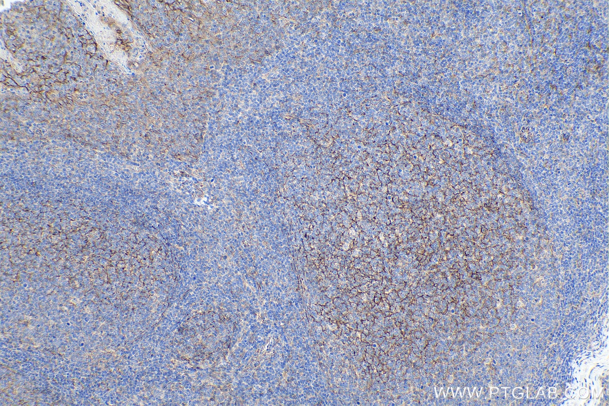Immunohistochemical analysis of paraffin-embedded human tonsillitis tissue slide using KHC0114 (Nectin-2/PVRL2 IHC Kit).