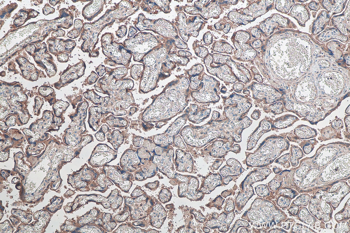 Immunohistochemical analysis of paraffin-embedded human placenta tissue slide using KHC0104 (Nectin-4/PVRL4 IHC Kit).