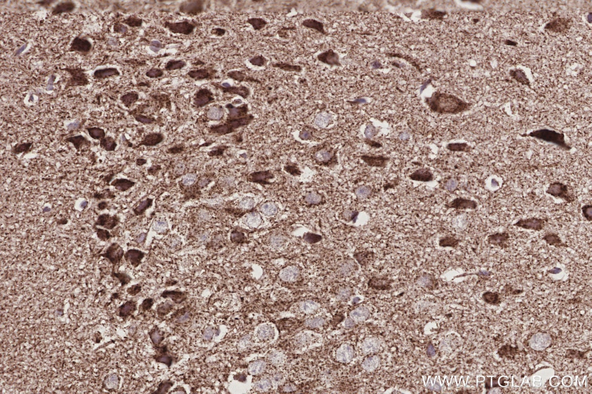 Immunohistochemical analysis of paraffin-embedded mouse brain tissue slide using KHC3034 (OGDHL IHC Kit). Immunohistochemical analysis of paraffin-embedded mouse brain tissue slide using KHC3034 (OGDHL IHC Kit).