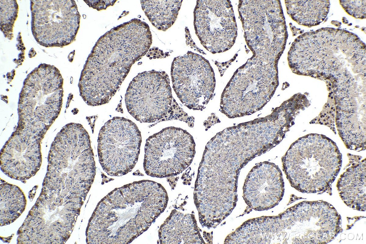 Immunohistochemical analysis of paraffin-embedded mouse testis tissue slide using KHC1442 (OGT IHC Kit).