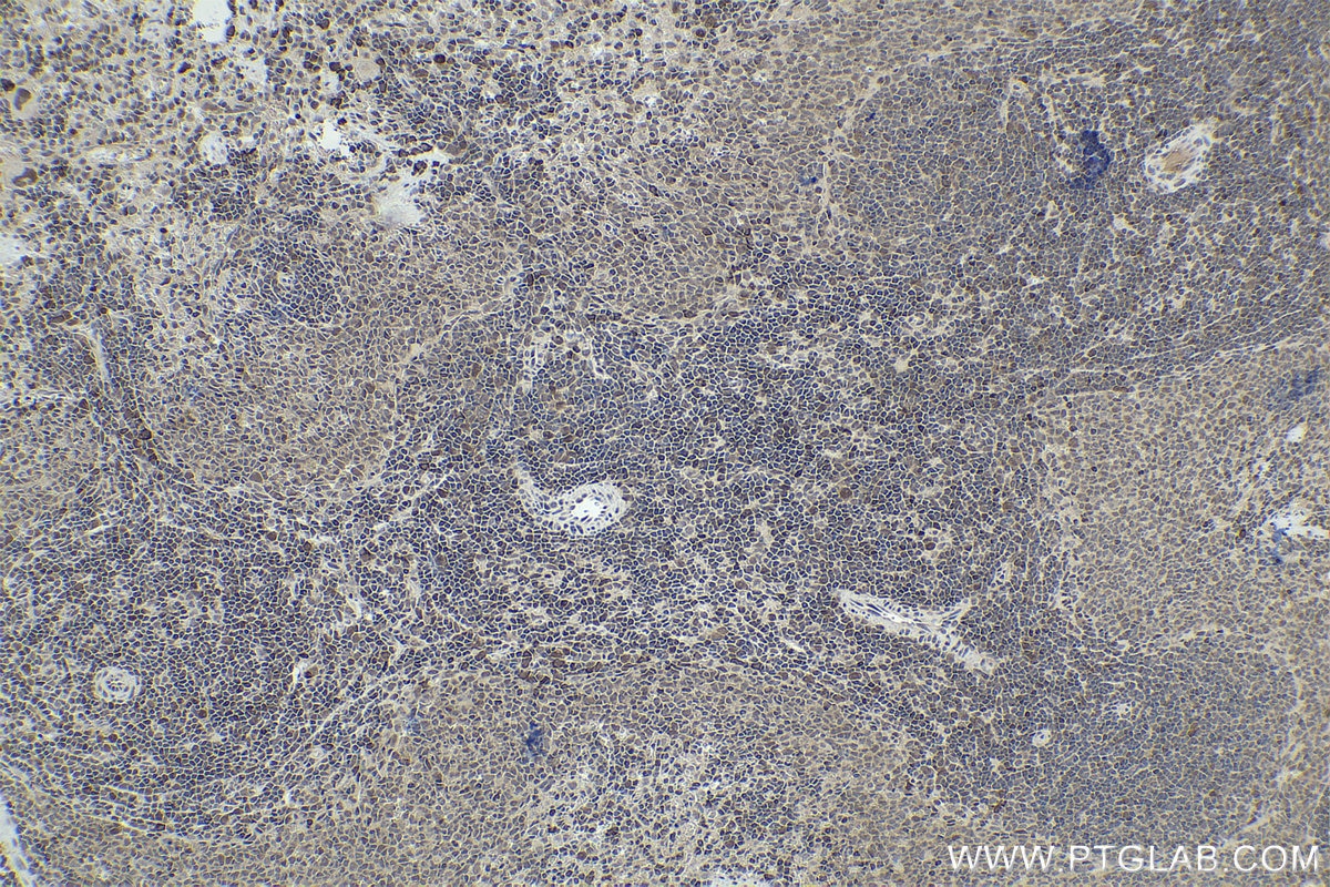 Immunohistochemical analysis of paraffin-embedded rat spleen tissue slide using KHC1442 (OGT IHC Kit).