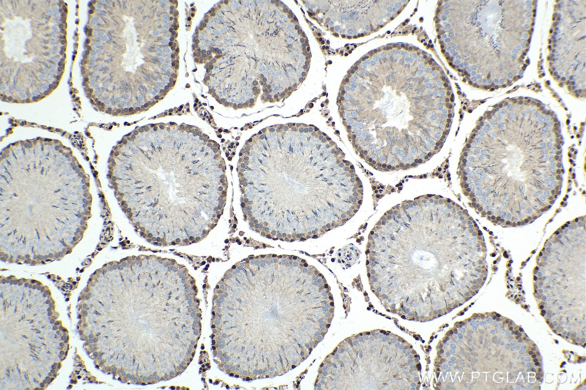 Immunohistochemical analysis of paraffin-embedded rat testis tissue slide using KHC1442 (OGT IHC Kit).