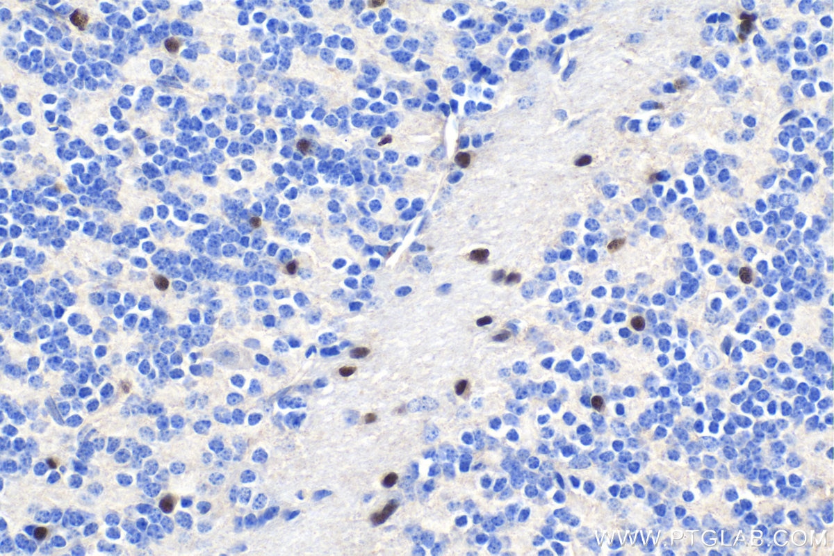 Immunohistochemical analysis of paraffin-embedded mouse cerebellum tissue slide using KHC1715 (OLIG2 IHC Kit).