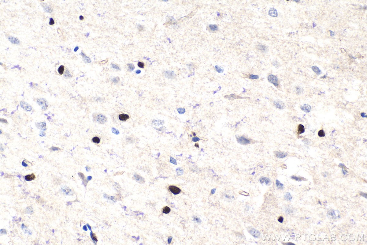 Immunohistochemical analysis of paraffin-embedded rat brain tissue slide using KHC1715 (OLIG2 IHC Kit).