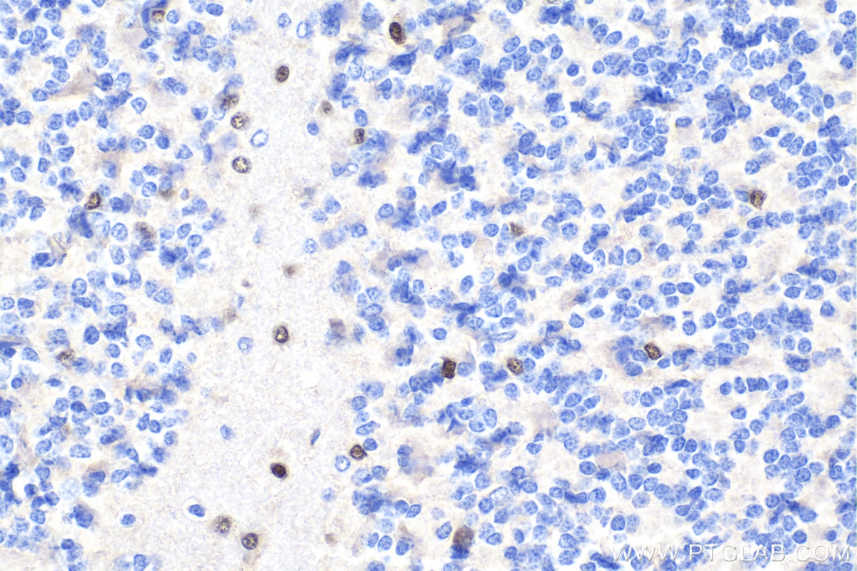 Immunohistochemical analysis of paraffin-embedded rat cerebellum tissue slide using KHC1715 (OLIG2 IHC Kit).