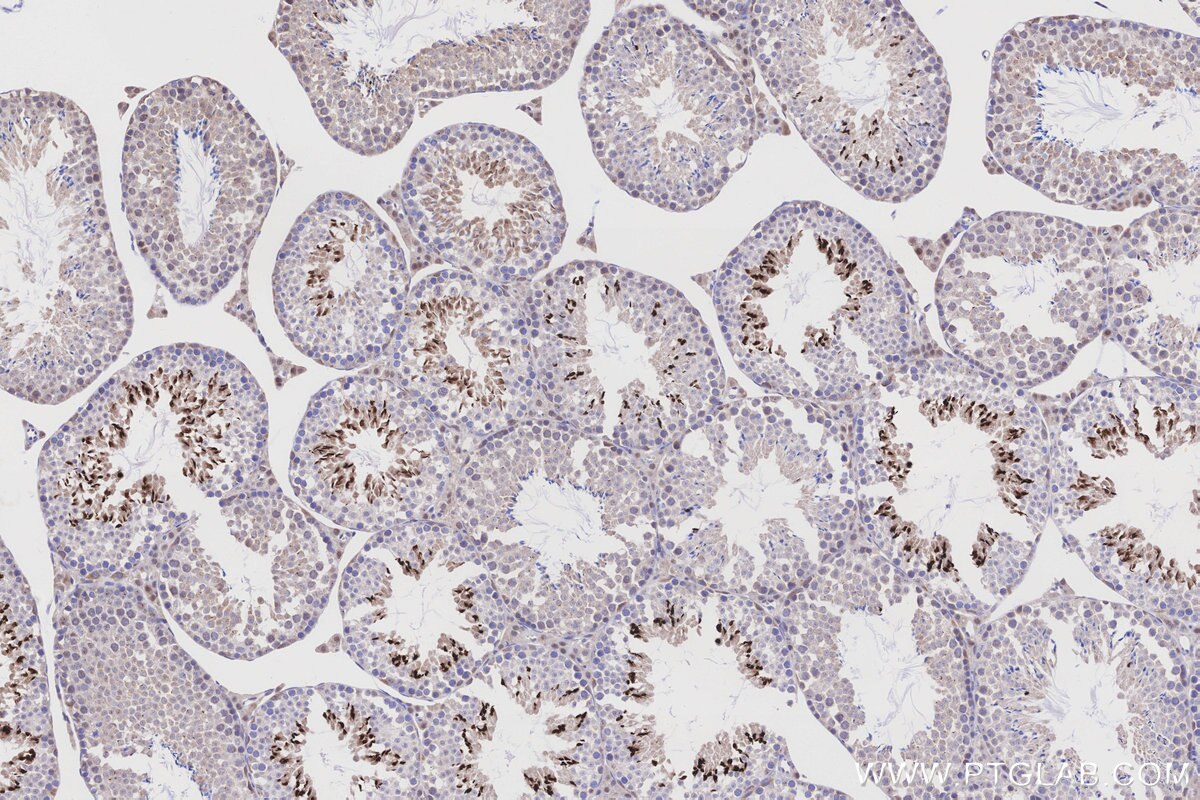 Immunohistochemical analysis of paraffin-embedded mouse testis tissue slide using KHC3206 (OPRM1 IHC Kit).