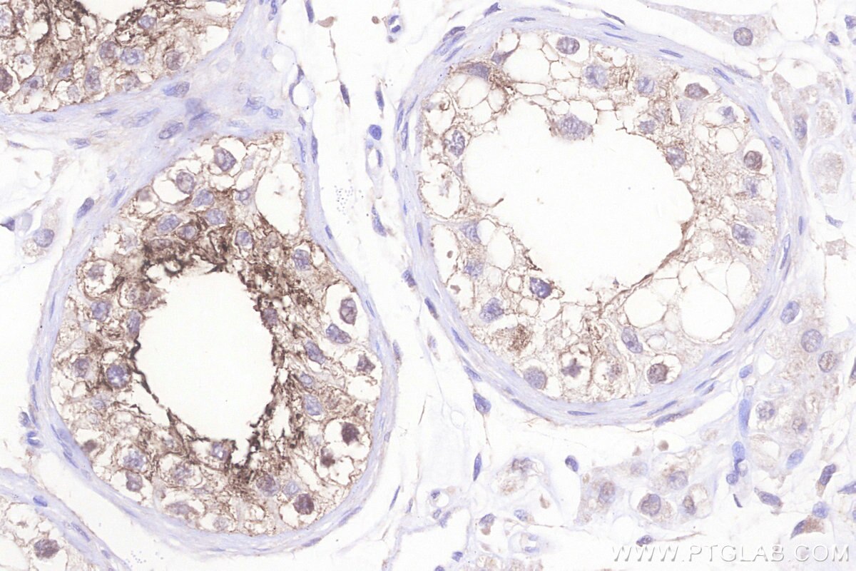 Immunohistochemical analysis of paraffin-embedded human testis tissue slide using KHC3206 (OPRM1 IHC Kit).