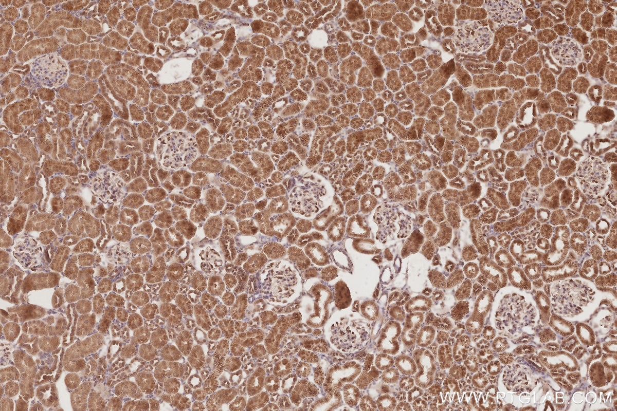 Immunohistochemical analysis of paraffin-embedded rat kidney tissue slide using KHC2881 (OSBPL10 IHC Kit).