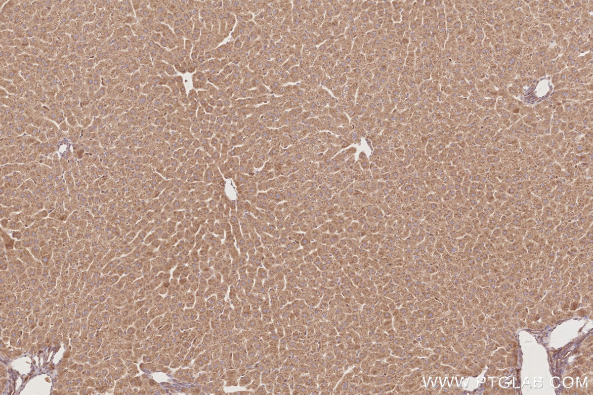 Immunohistochemical analysis of paraffin-embedded rat liver tissue slide using KHC2880 (OSBPL11 IHC Kit).