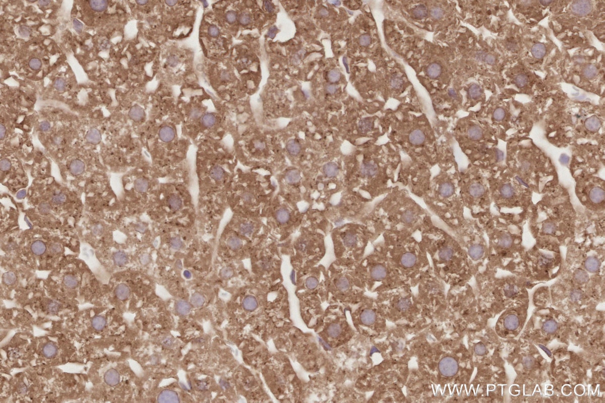 Immunohistochemical analysis of paraffin-embedded mouse liver tissue slide using KHC2880 (OSBPL11 IHC Kit).