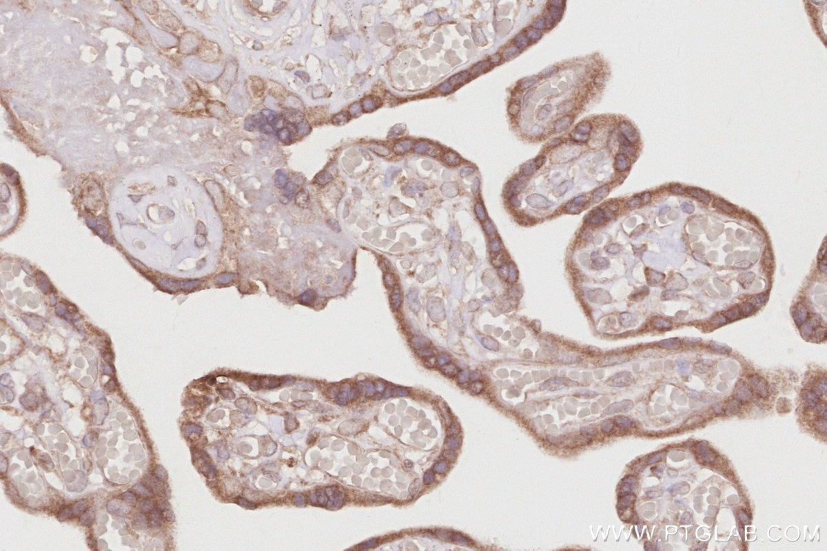 Immunohistochemical analysis of paraffin-embedded human placenta tissue slide using KHC2900 (OSBPL5 IHC Kit).