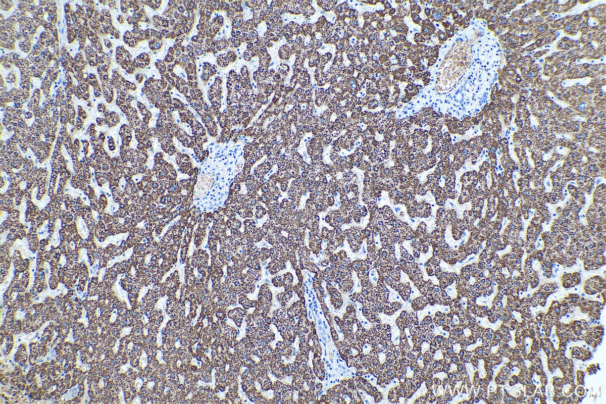 Immunohistochemical analysis of paraffin-embedded human liver tissue slide using KHC0493 (OTC IHC Kit).