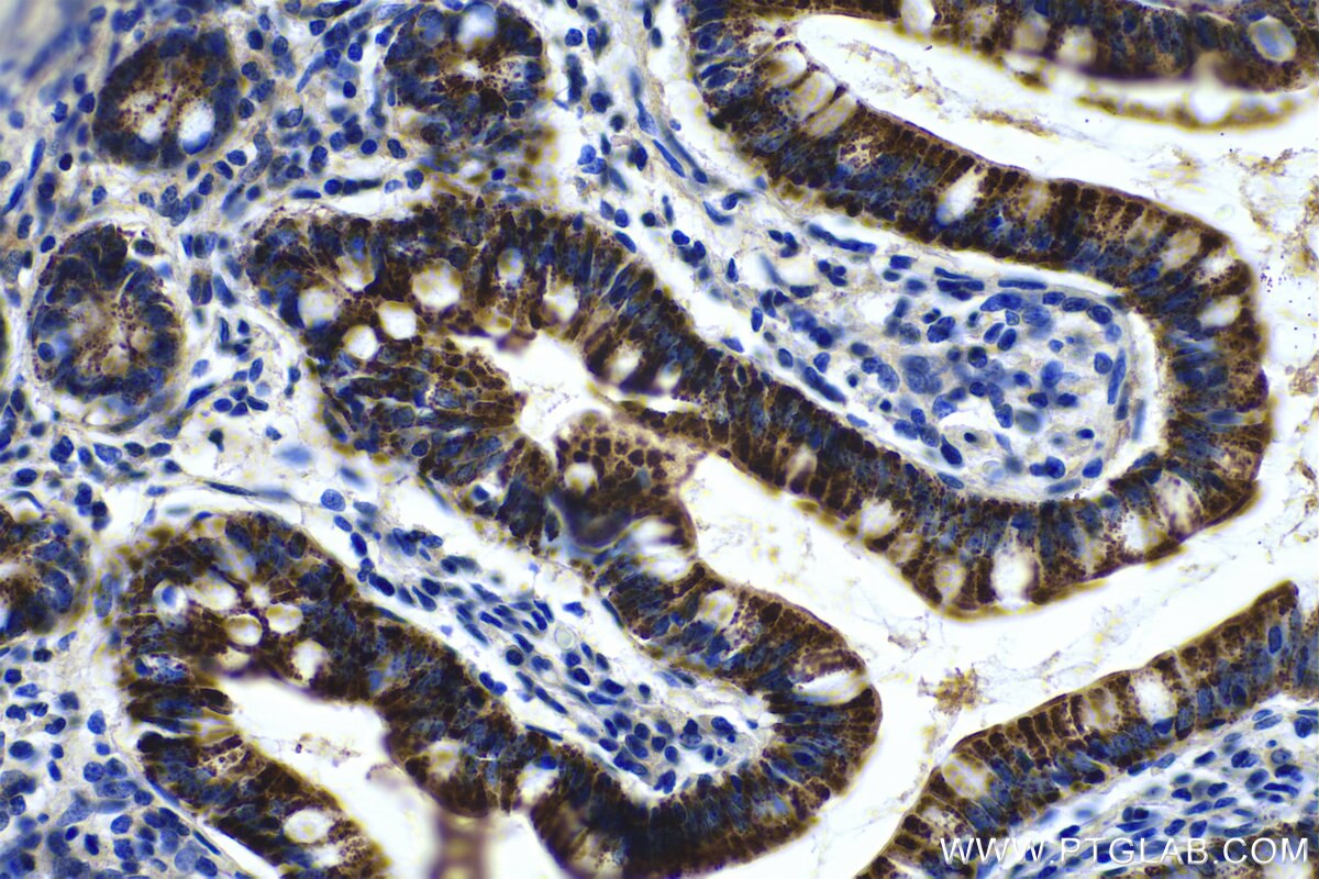 Immunohistochemical analysis of paraffin-embedded human small intestine tissue slide using KHC0493 (OTC IHC Kit).