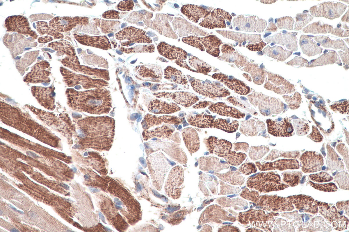 Immunohistochemical analysis of paraffin-embedded mouse heart tissue slide using KHC0888 (OXCT1 IHC Kit).