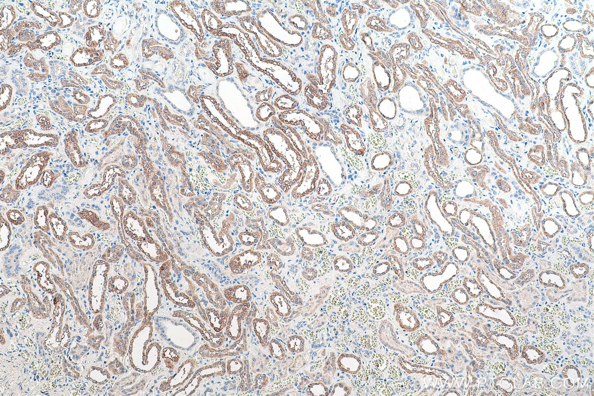 Immunohistochemical analysis of paraffin-embedded human kidney tissue slide using KHC0888 (OXCT1 IHC Kit).