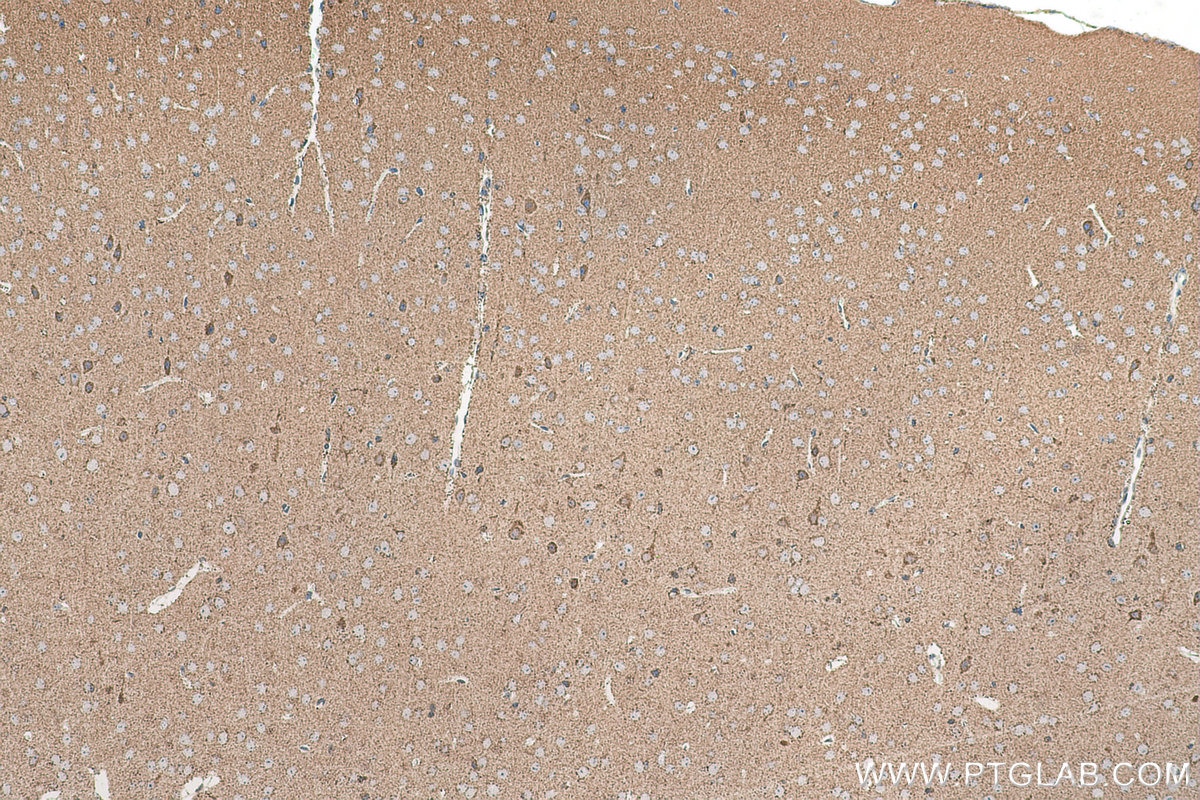 Immunohistochemical analysis of paraffin-embedded mouse brain tissue slide using KHC0888 (OXCT1 IHC Kit).