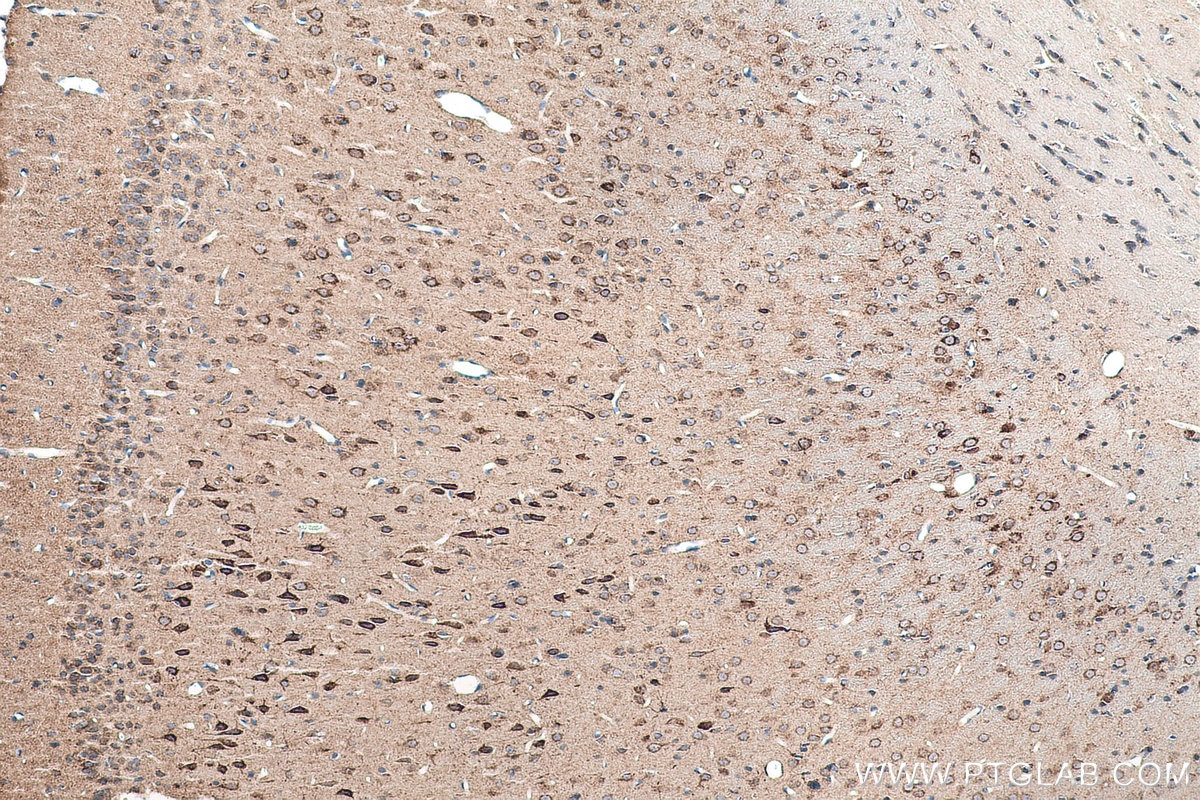 Immunohistochemical analysis of paraffin-embedded rat brain tissue slide using KHC0888 (OXCT1 IHC Kit).