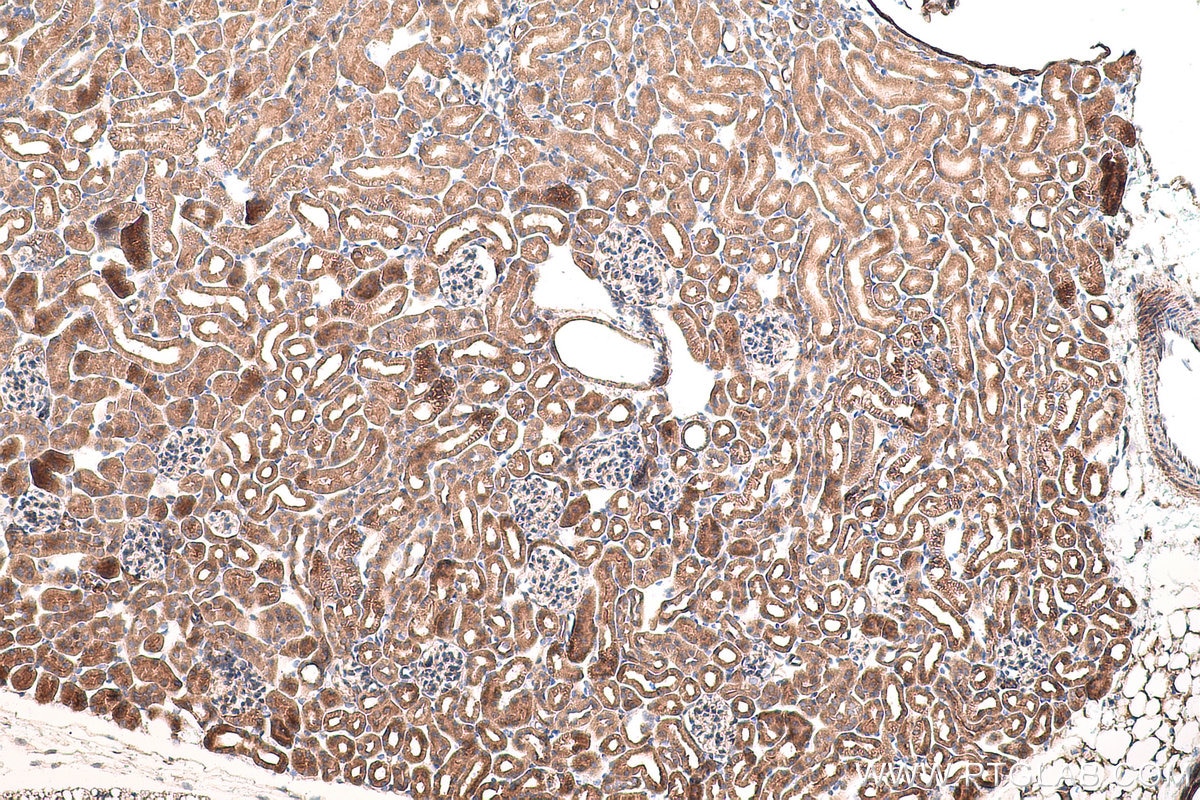 Immunohistochemical analysis of paraffin-embedded mouse kidney tissue slide using KHC0782 (Osteopontin/SPP1 IHC Kit).
