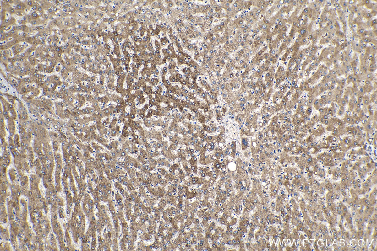 Immunohistochemical analysis of paraffin-embedded human liver tissue slide using KHC1229 (P4HA1 IHC Kit).