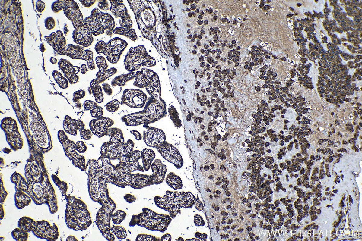 Immunohistochemical analysis of paraffin-embedded human placenta tissue slide using KHC1229 (P4HA1 IHC Kit).