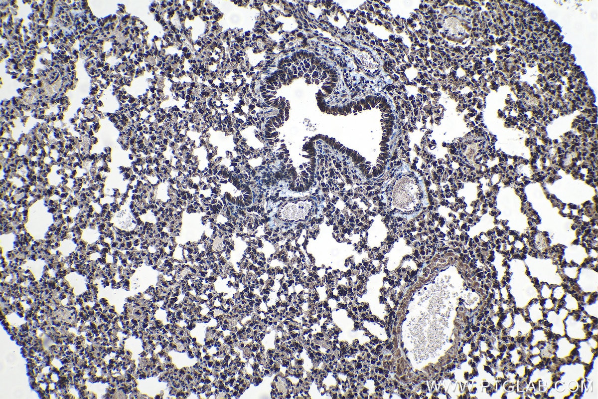 Immunohistochemical analysis of paraffin-embedded mouse lung tissue slide using KHC1229 (P4HA1 IHC Kit).