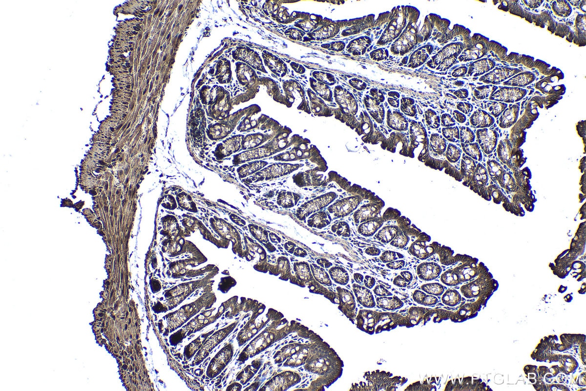 Immunohistochemical analysis of paraffin-embedded mouse colon tissue slide using KHC1369 (P4HA2 IHC Kit).