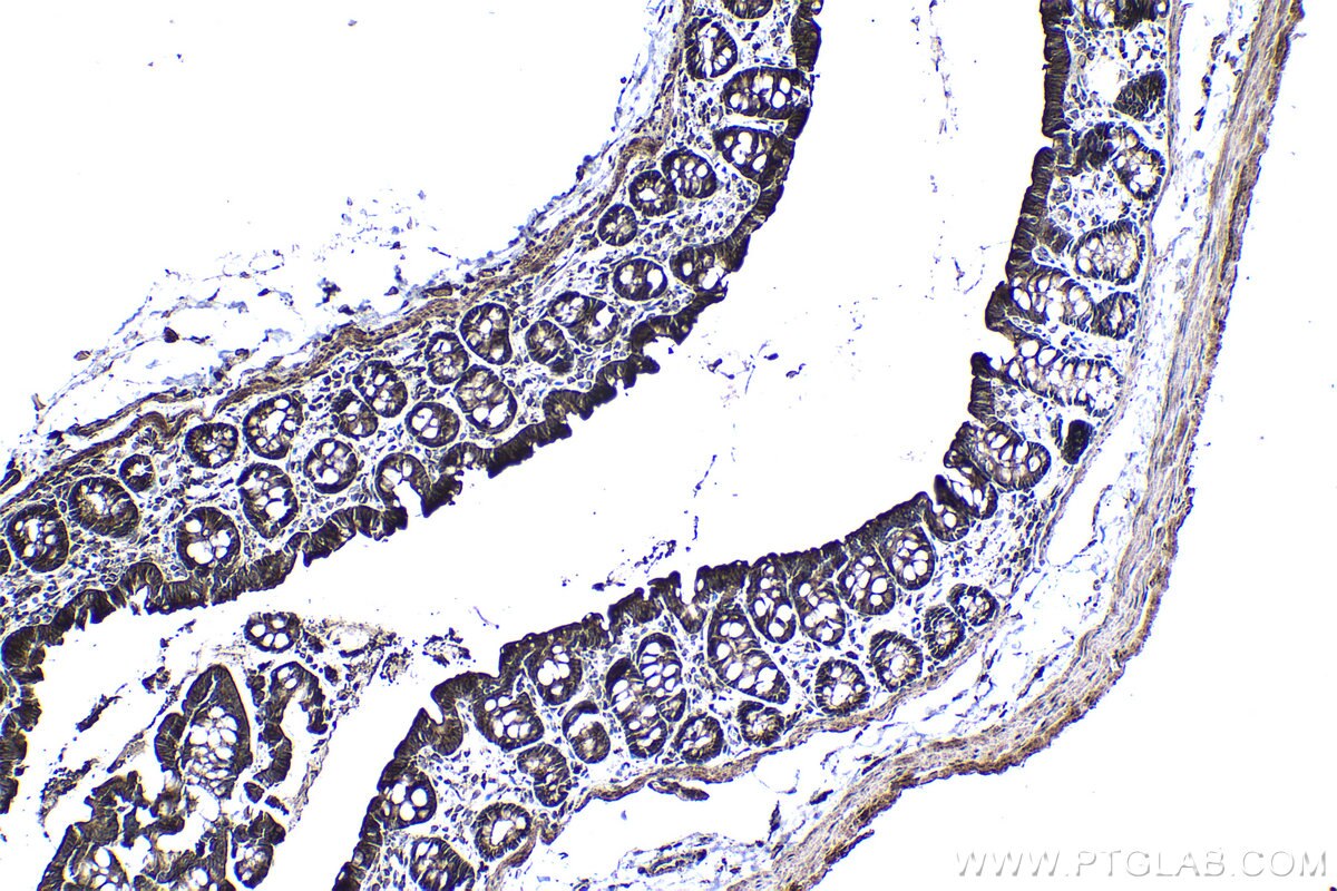 Immunohistochemical analysis of paraffin-embedded rat colon tissue slide using KHC1369 (P4HA2 IHC Kit).