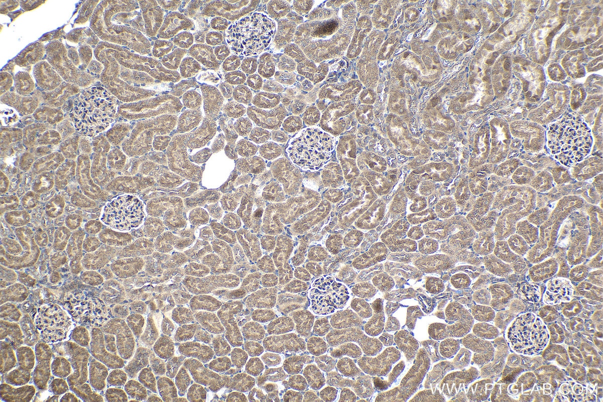 Immunohistochemical analysis of paraffin-embedded rat kidney tissue slide using KHC1369 (P4HA2 IHC Kit).