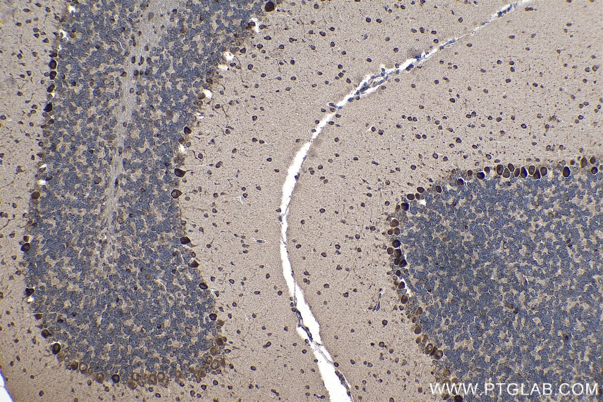 Immunohistochemical analysis of paraffin-embedded mouse cerebellum tissue slide using KHC1141 (PABPC1 IHC Kit).