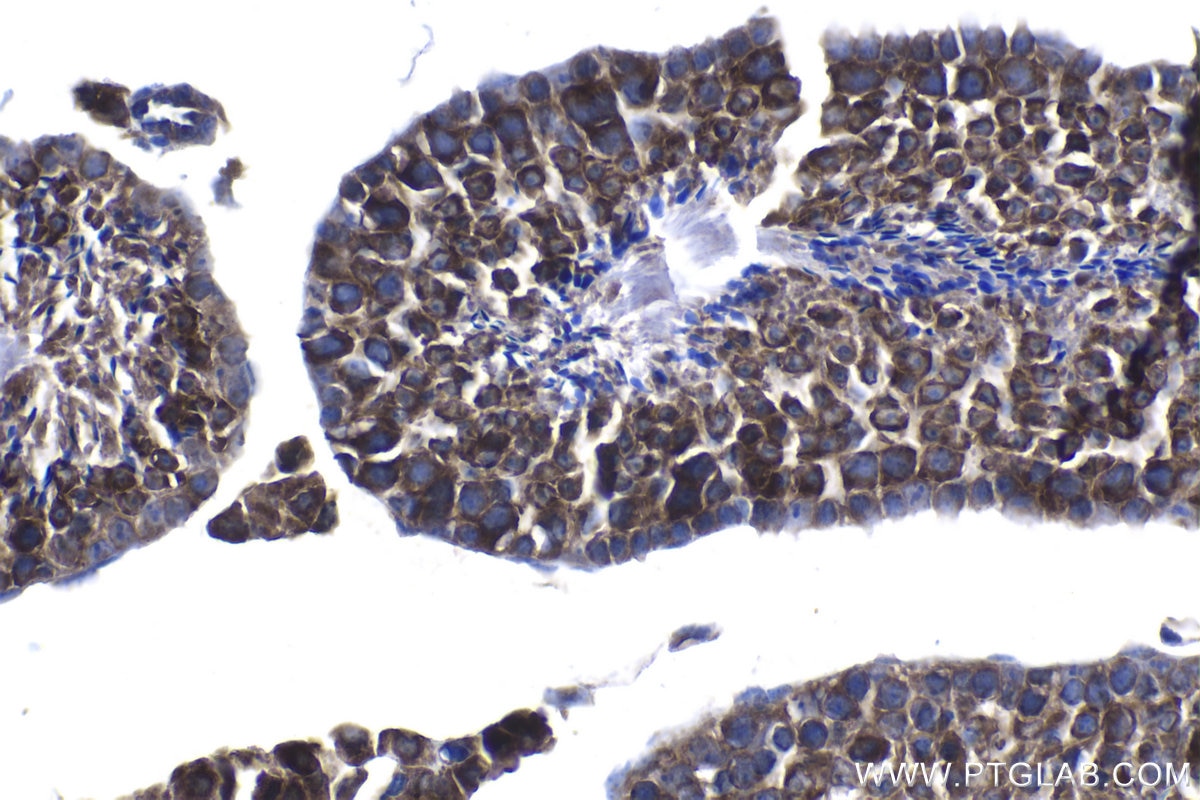 Immunohistochemical analysis of paraffin-embedded mouse testis tissue slide using KHC1290 (PABPC3 IHC Kit).