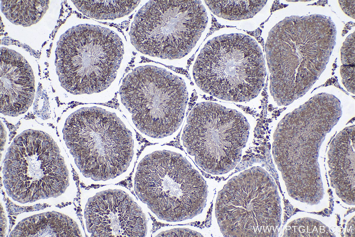 Immunohistochemical analysis of paraffin-embedded rat testis tissue slide using KHC1290 (PABPC3 IHC Kit).