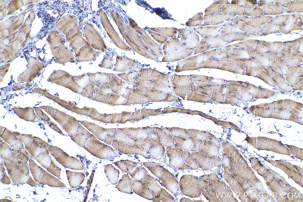 Immunohistochemical analysis of paraffin-embedded rat skeletal muscle tissue slide using KHC0908 (PABPC4 IHC Kit).