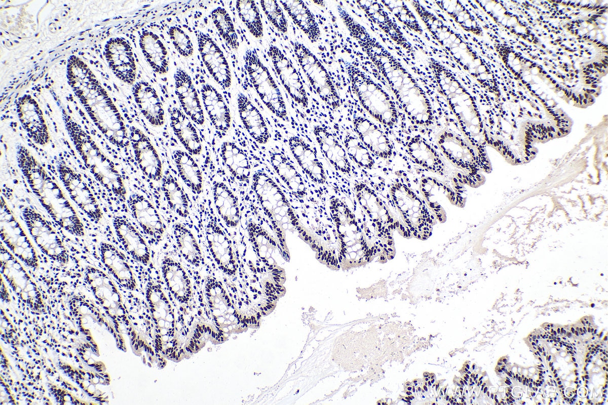 Immunohistochemical analysis of paraffin-embedded human colon tissue slide using KHC0316 (PABPN1 IHC Kit).
