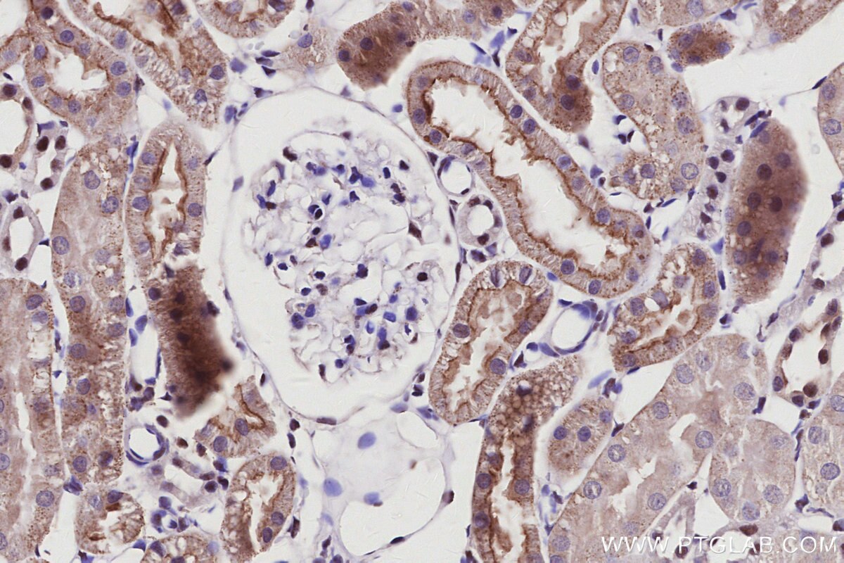 Immunohistochemical analysis of paraffin-embedded rat kidney tissue slide using KHC2944 (PAK6 IHC Kit).