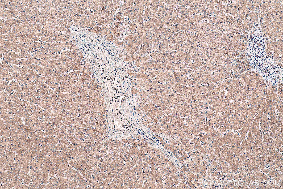 Immunohistochemical analysis of paraffin-embedded human liver tissue slide using KHC0443 (PALMD IHC Kit).