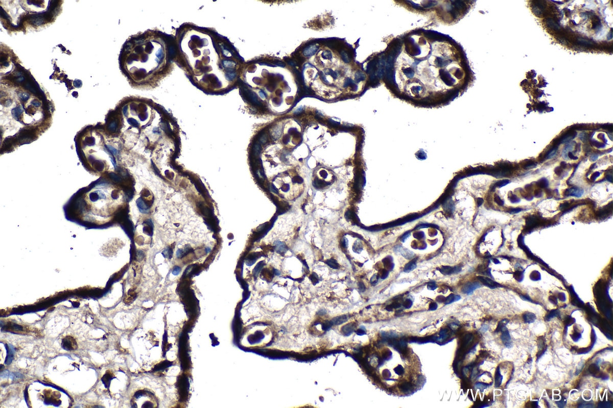 Immunohistochemical analysis of paraffin-embedded human placenta tissue slide using KHC1321 (PAPPA IHC Kit).