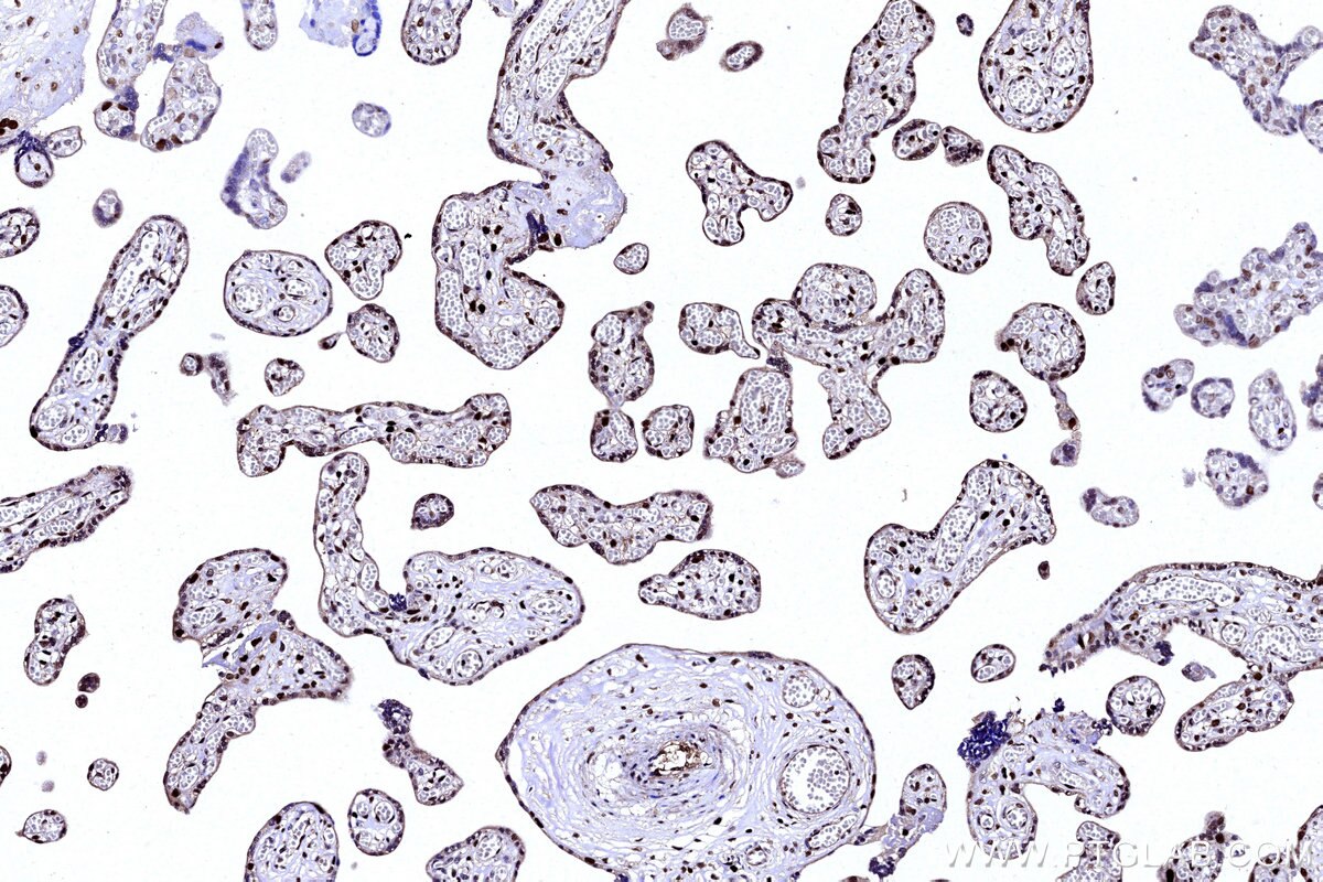 Immunohistochemical analysis of paraffin-embedded human placenta tissue slide using KHC3141 (PAPSS1 IHC Kit). Immunohistochemical analysis of paraffin-embedded human placenta tissue slide using KHC3141 (PAPSS1 IHC Kit).