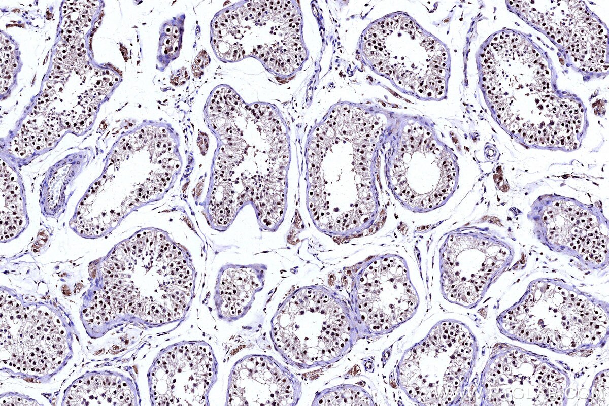 Immunohistochemical analysis of paraffin-embedded human testis tissue slide using KHC3141 (PAPSS1 IHC Kit). Immunohistochemical analysis of paraffin-embedded human testis tissue slide using KHC3141 (PAPSS1 IHC Kit).