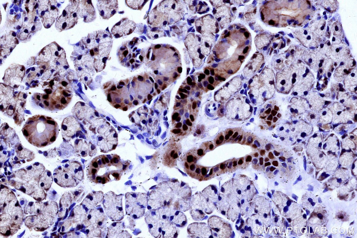 Immunohistochemical analysis of paraffin-embedded rat salivary gland tissue slide using KHC3141 (PAPSS1 IHC Kit). Immunohistochemical analysis of paraffin-embedded rat salivary gland tissue slide using KHC3141 (PAPSS1 IHC Kit).