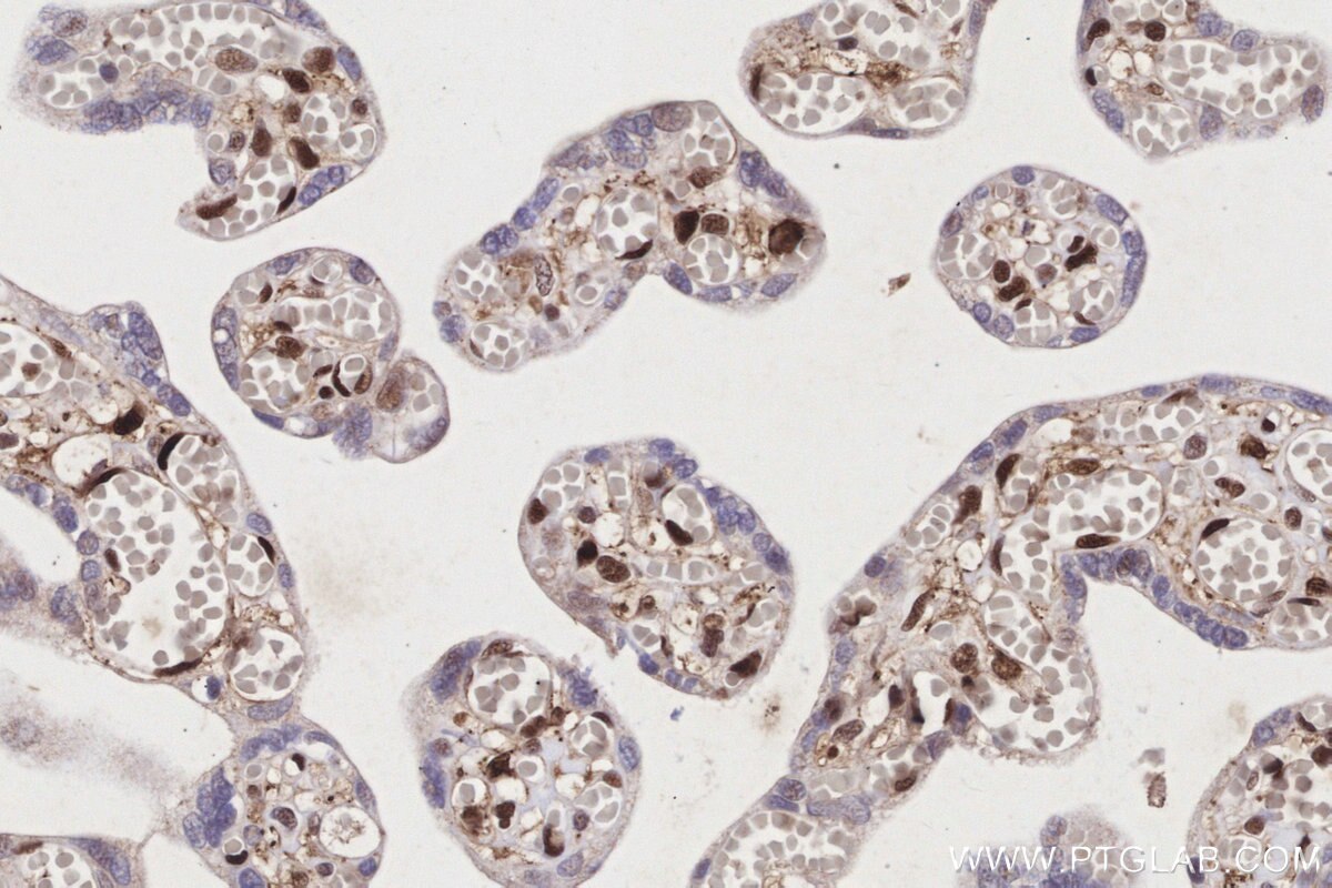 Immunohistochemical analysis of paraffin-embedded human placenta tissue slide using KHC3156 (PAPSS2 IHC Kit).